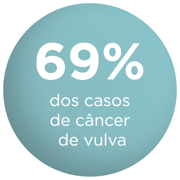 69% dos casos de câncer de vulva